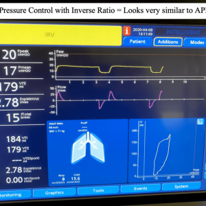 REBEL Crit Cast Ep3.0: вентиляция со сбросом давления в дыхательных путях (APRV)