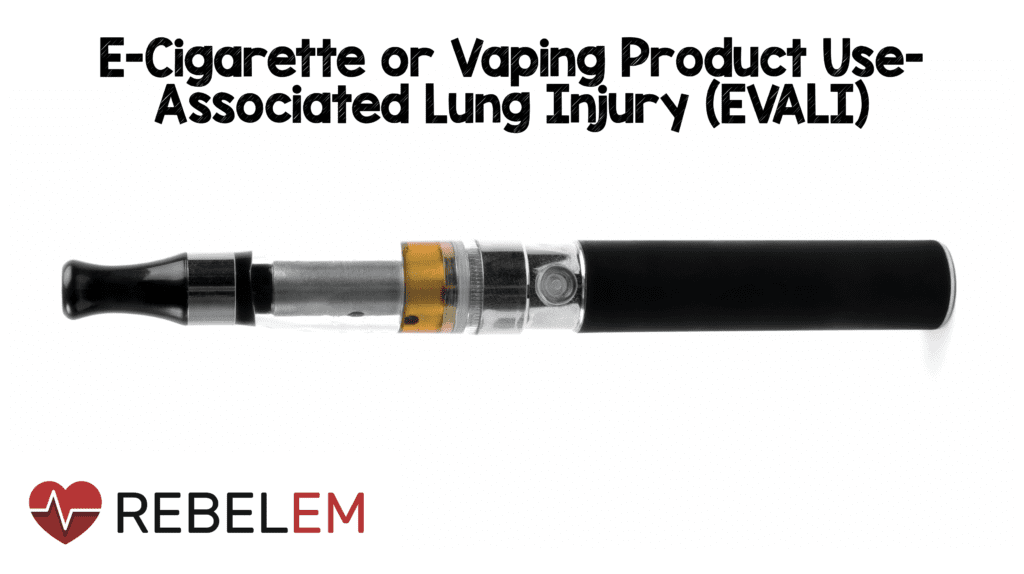 Травма легких, связанная с употреблением электронных сигарет или электронных сигарет (EVALI)
